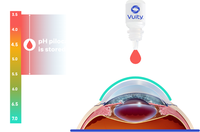 Illustration of how VUITYTM prescription eyedrop impacts near and intermediate blurry vision due to age-related presbyopia